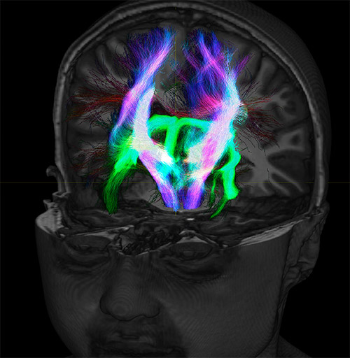 UVM research fiber tracking density