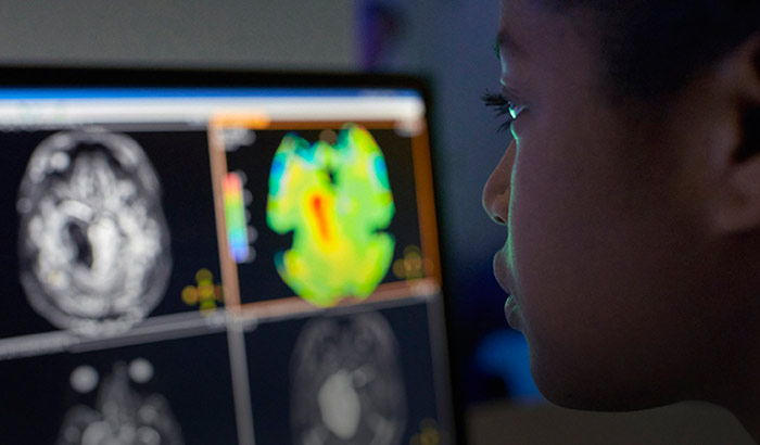 apt brain tumor mri home thumbnail