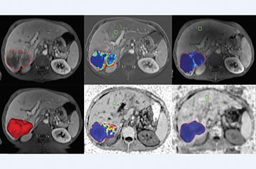 multi modality tumor tracking qeasl