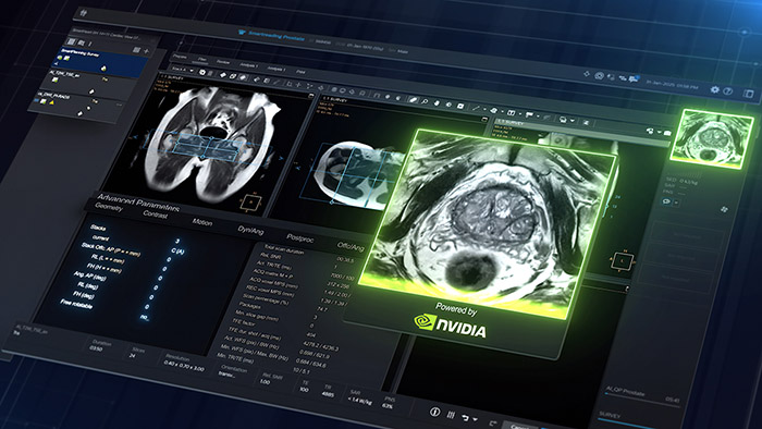 Seeing before scanning: Philips&rsquo;&nbsp;predictive preview on the path to autonomous MRI